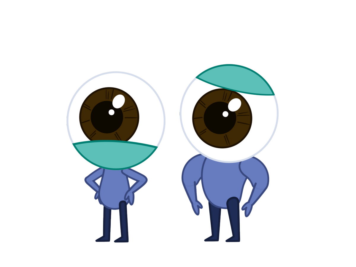 Illustration of the more active eye and the eye that works less.